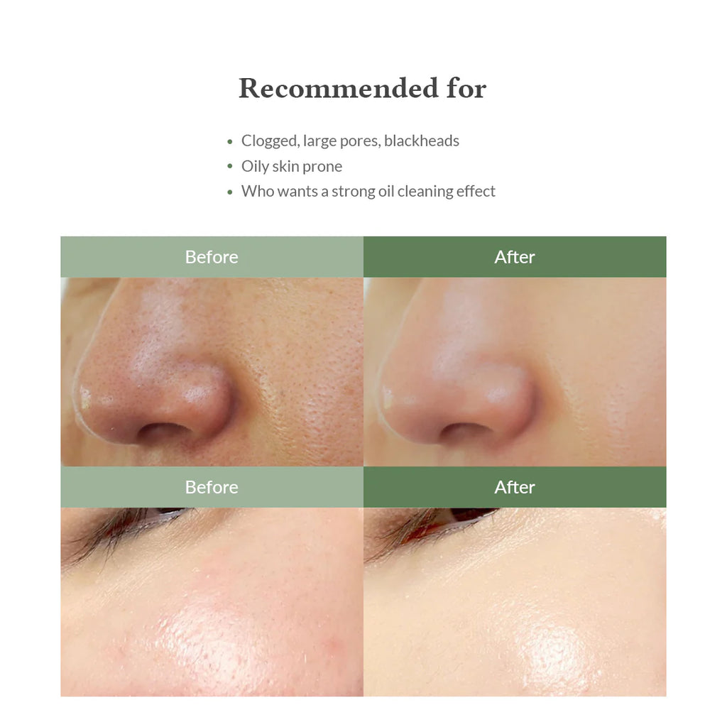 Limpiador Premium Quick Step Sebum Cleanser Dr. Althea