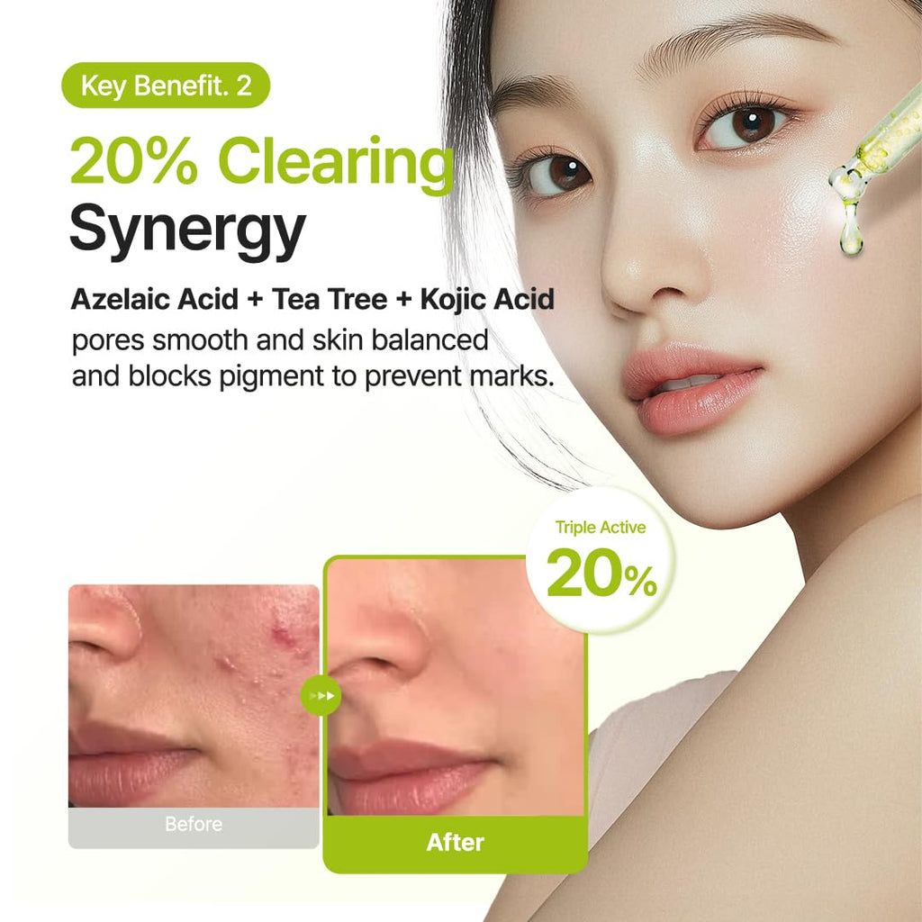 Suero Azelaic Acid 10 Kojic Tea Tree Serum Purito
